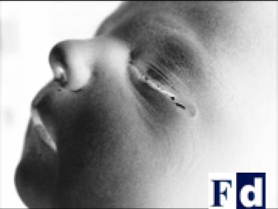 Volontà in contrasto: l’aborto non è solo un atto di salute Volontà in contrasto: l’aborto non è solo un atto di salute
