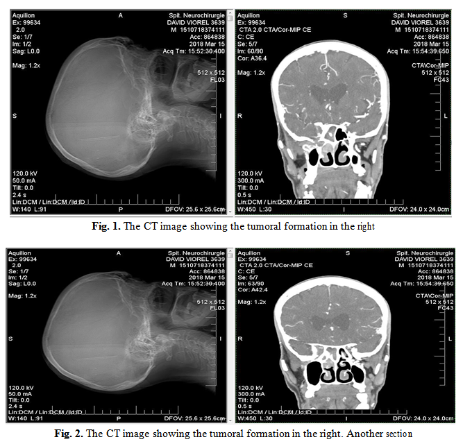 Fig. 1 e 2