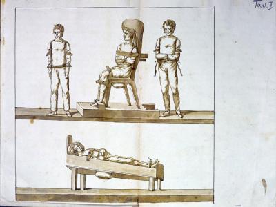 Disegni di sistemi di contenzione