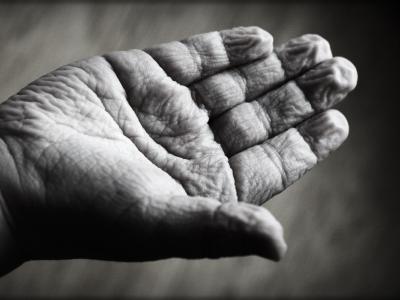 Aging